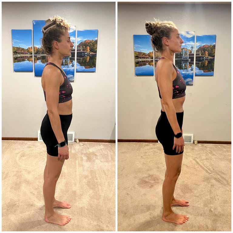 before and after of a woman who had severe back pain demonstrating improved posture 