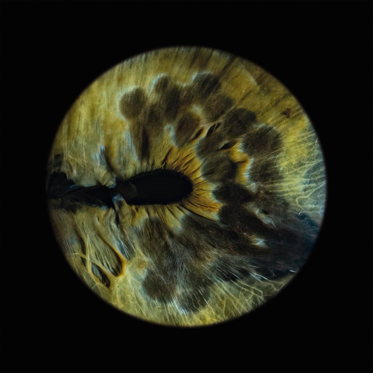 zdjęcie tęczówki oka wykonane w A-EYE Gallery. oko z rozszczepem tęczówki, wyglądające jak ogon pawia