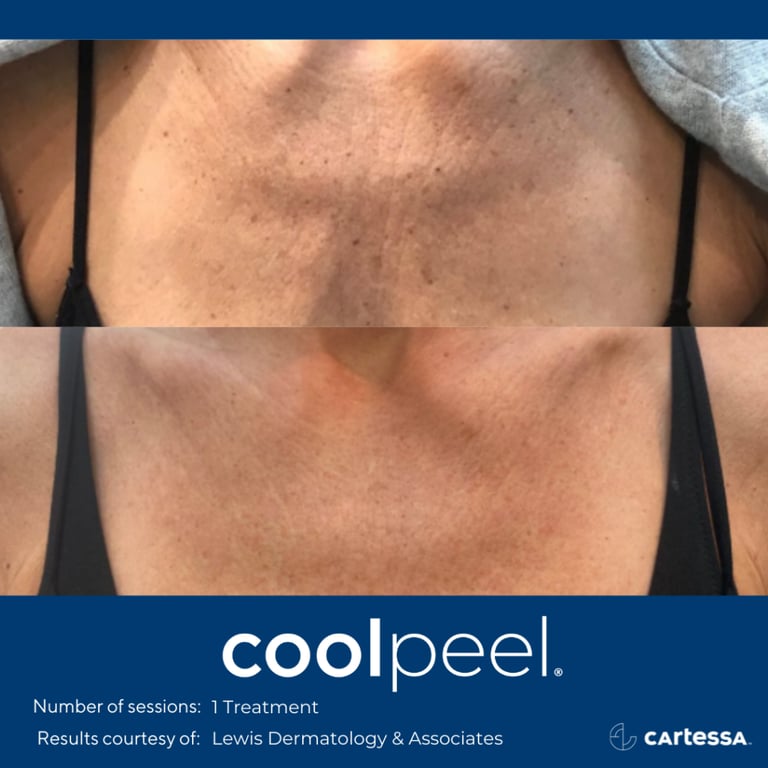 a woman with a very large chest and a very small chest