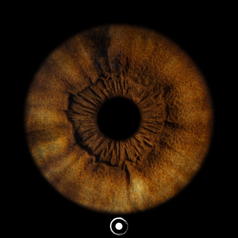 TheOculis®, Iris JPG®