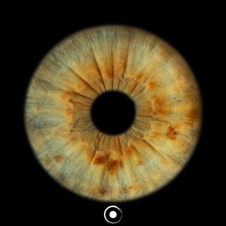 TheOculis®, Iris JPG®