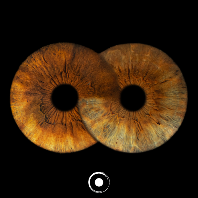 The Oculis®, Infiniteye®