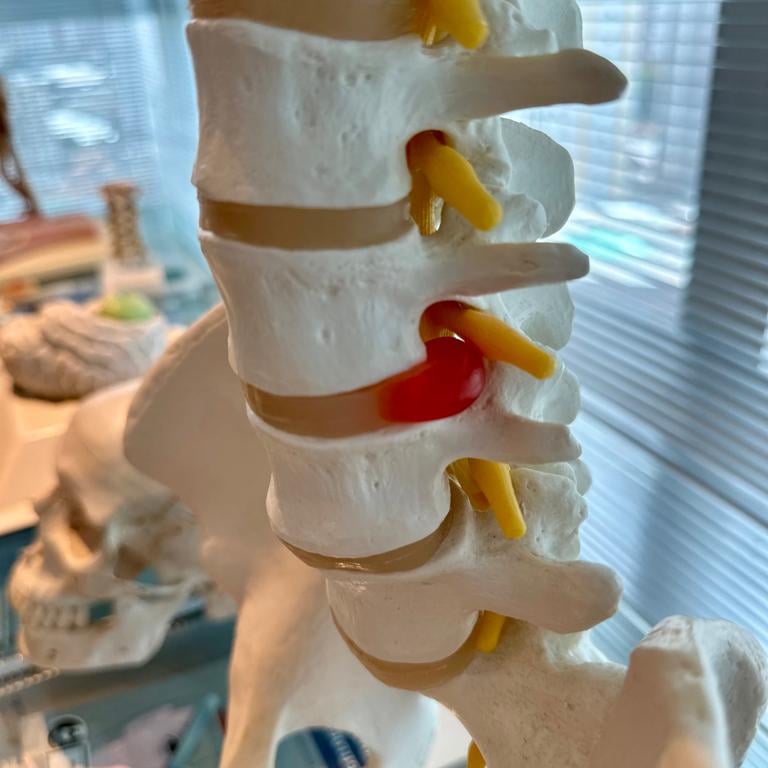 Dr Gilnard opera hérnia de disco em Fortaleza Ceará