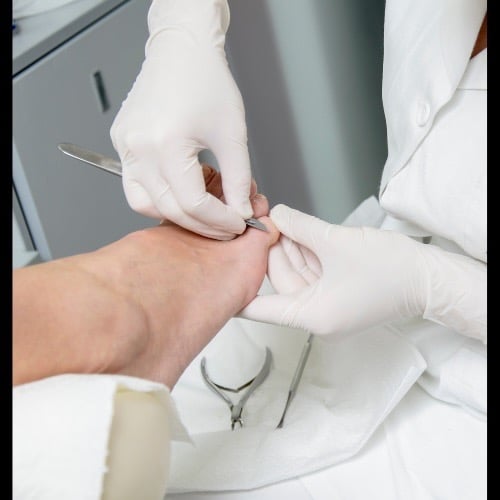 Professionele behandeling van een voet door een medisch pedicure.