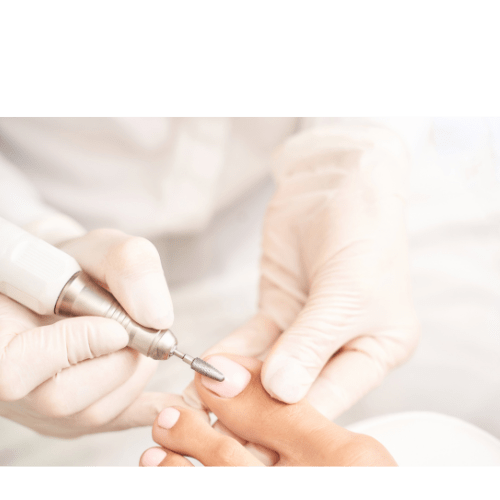 Teennagelverzorging met een elektrische frees uitgevoerd door een pedicure specialist.