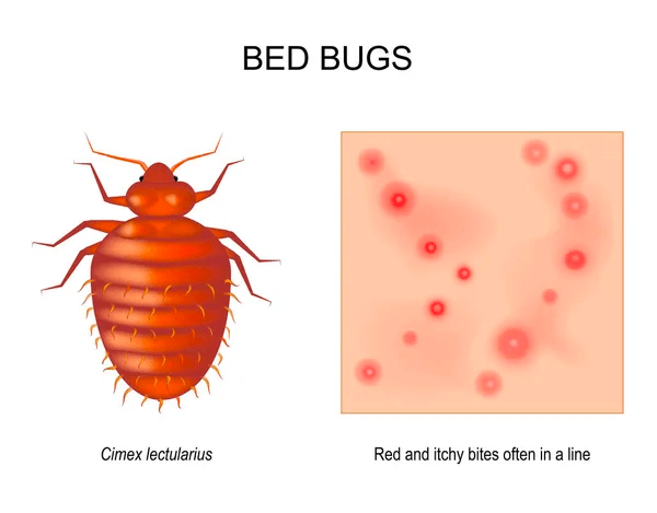 what do bed bugs bites look like