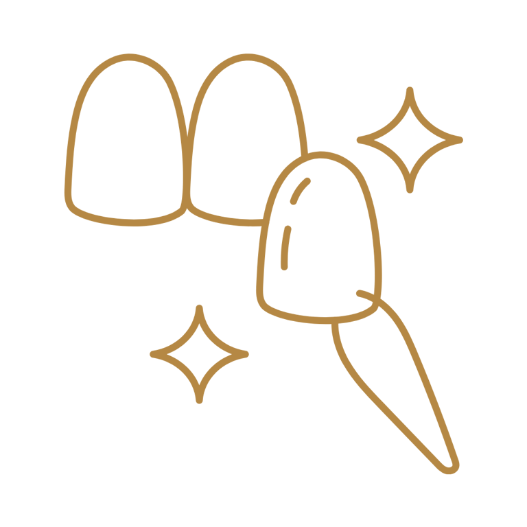 desenho de uma faceta dental em resina e porcelanato em são Mateus do Sul