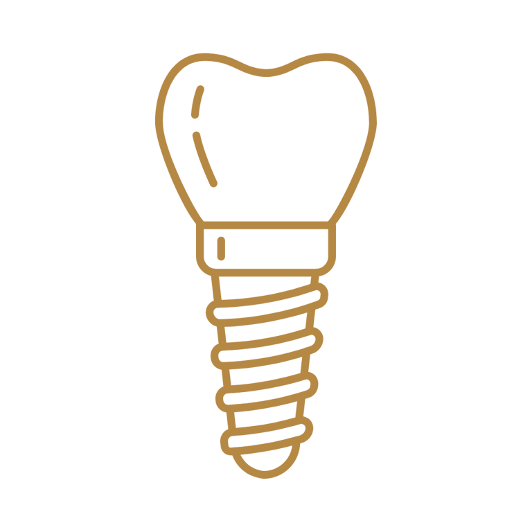 Desenho de um implante dentário em São Mateus do Sul