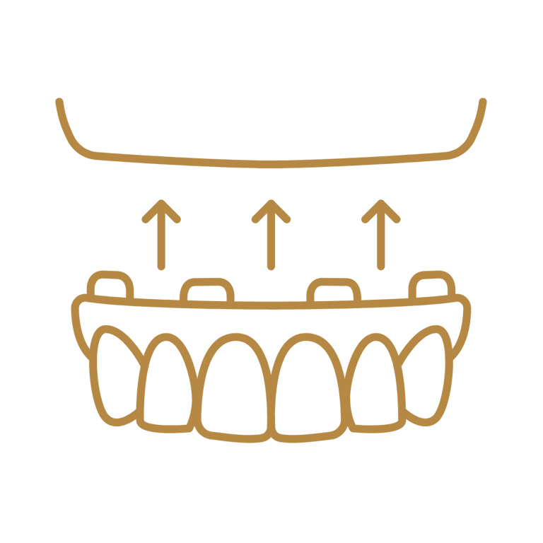 Prótese protocolo em São Mateus do Sul na clínica GT odontologia