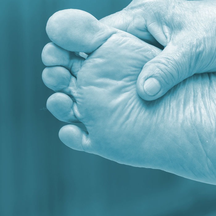 Tratamento Pé Diabético