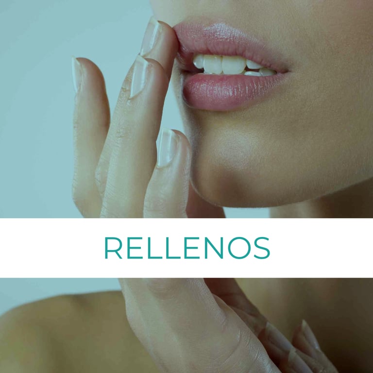 rellenos acido hialuronico