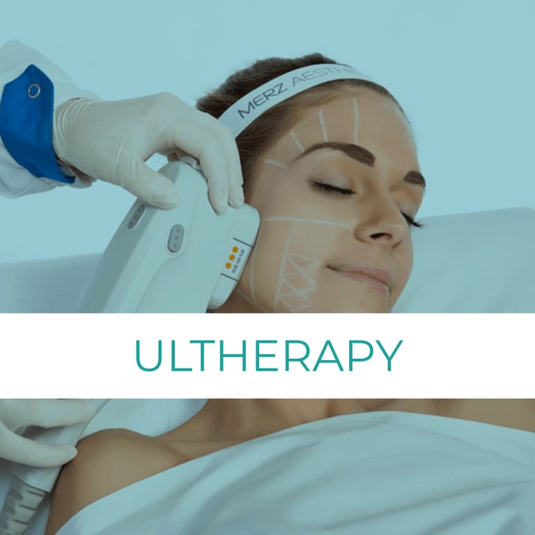 ultherapy lifting sin cirugia