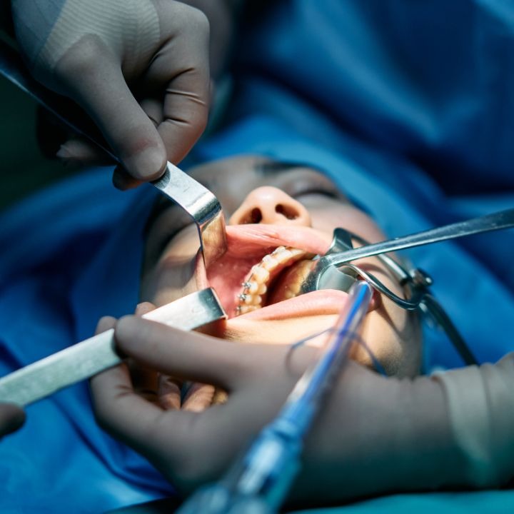 oral surgery