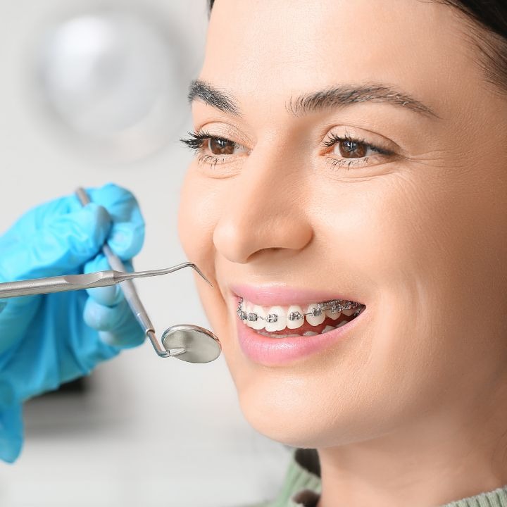 orthodontic braces