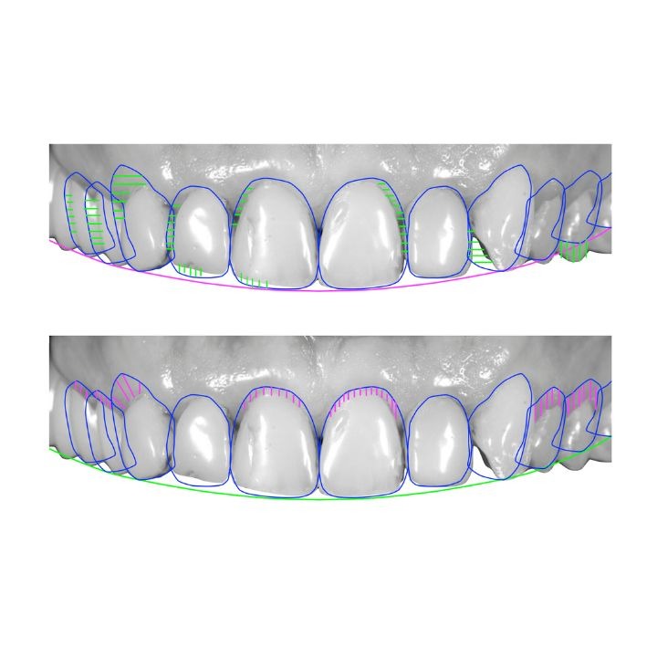 smile design