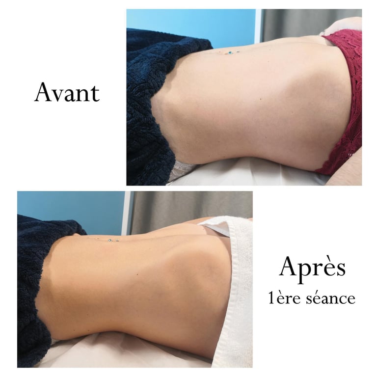 Renata França Ventre