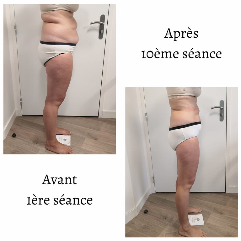 Endospheres Therapy Corps