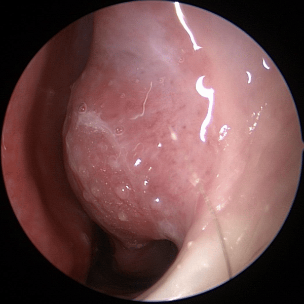 videonaso em curitiba