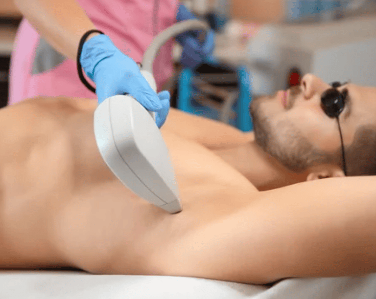 a men getting laser hair removal