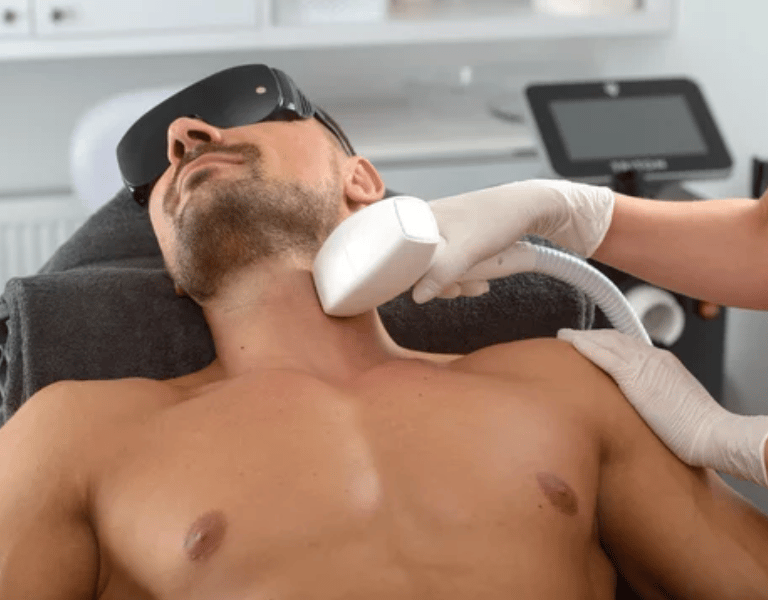 a men getting laser hair removal