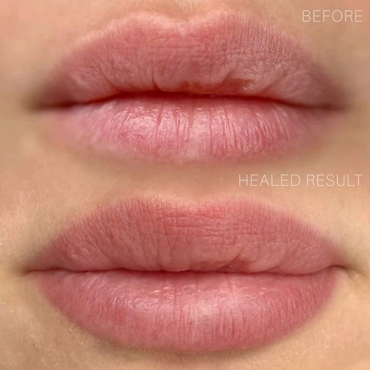 picture of Permanent Makeup Lip Blush