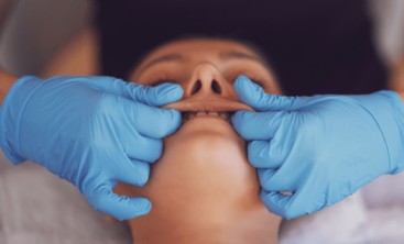 Maux de tête et migraine + douleur a la machoire