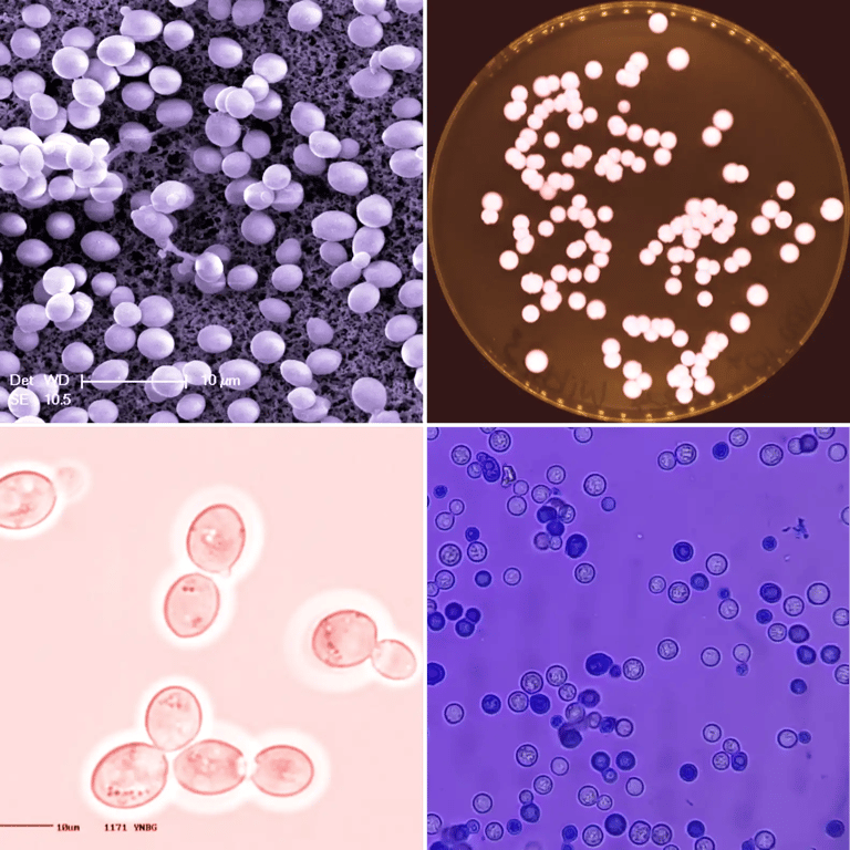 Yeast under the  microscope