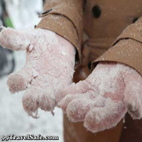 The Prevention and Treatment of Frostbite