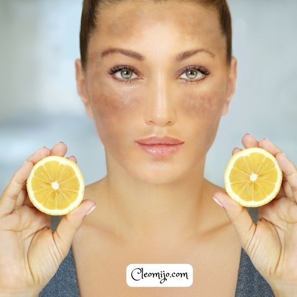 natural remedies for skin lightening
