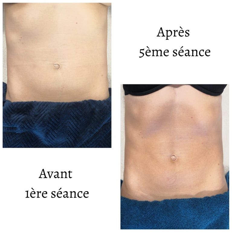 Renata França Ventre