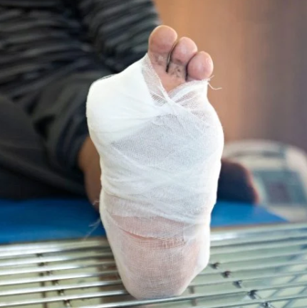 Diabetic Wound Care At home 