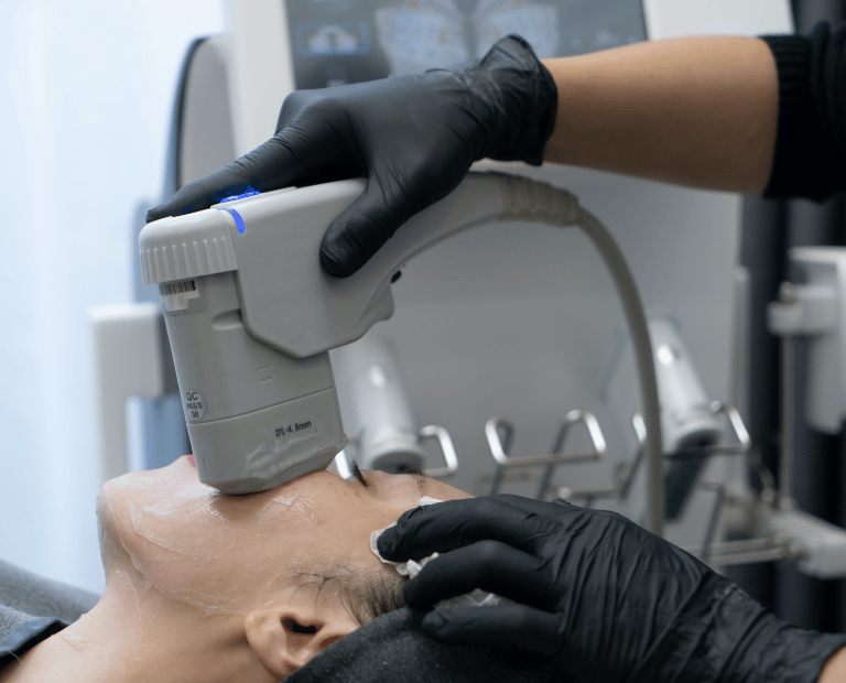 woman receiving HIFU treatment on cheek