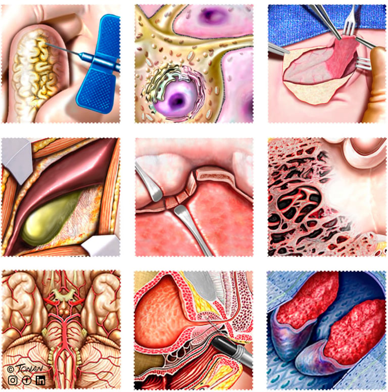 Grade de ilustrações anatômicas e médicas por Rodrigo Tonan – detalhes de anatomia cirurgia e fisiol