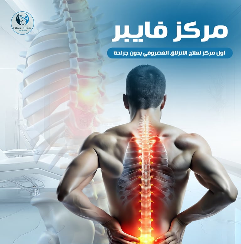 علاج الانزلاق الغضروفي بدون جراحة
