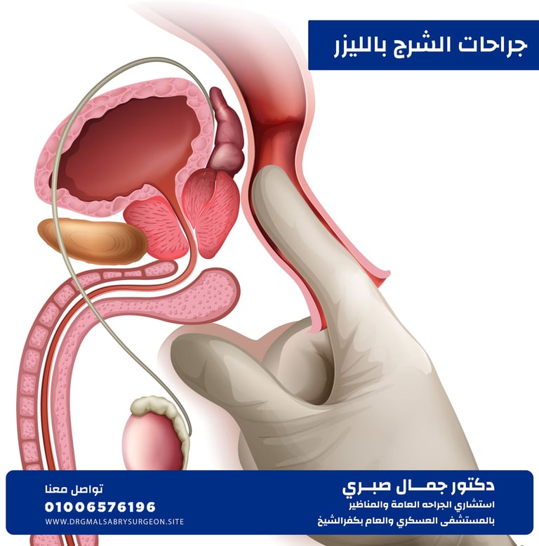 جراحــات الشرج كفرالشيخ