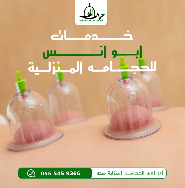 حجامه مكه ابوانس