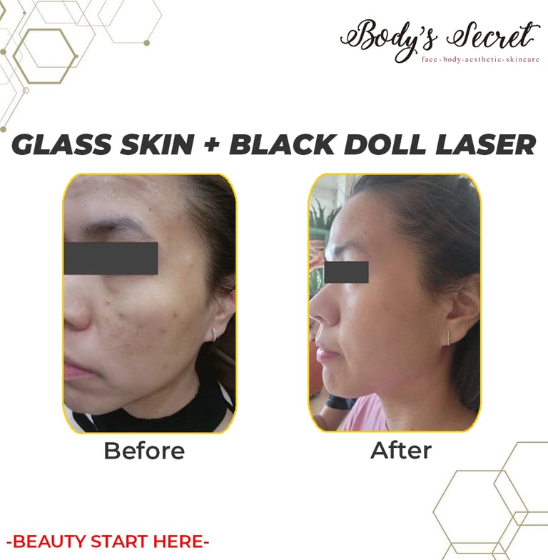 Body's Secret black doll laser