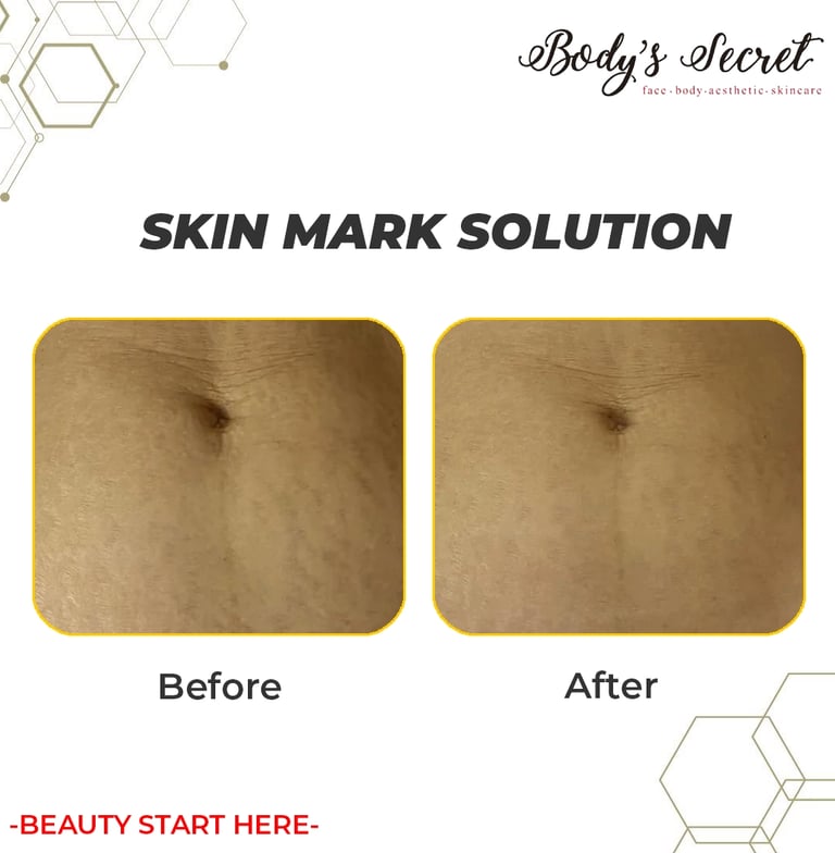Body's Secret skin mark solution