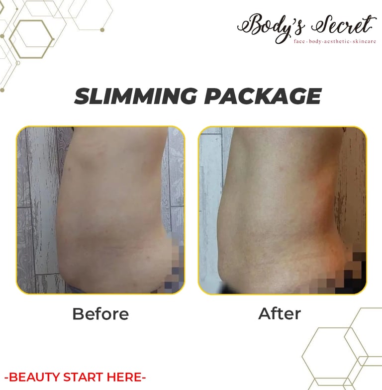 Body's Secret testimonial slimming