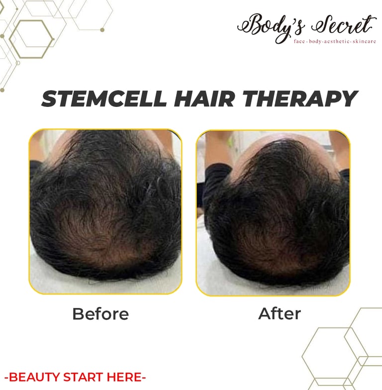 Body's Secret stem cell hair therapy
