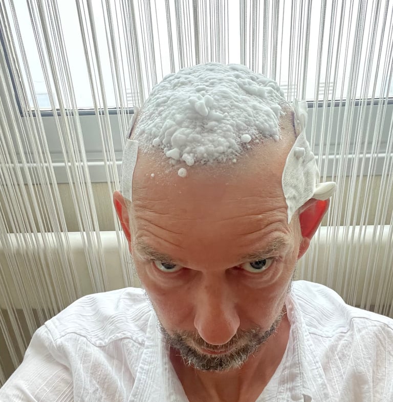 hair transplant dressings being removed