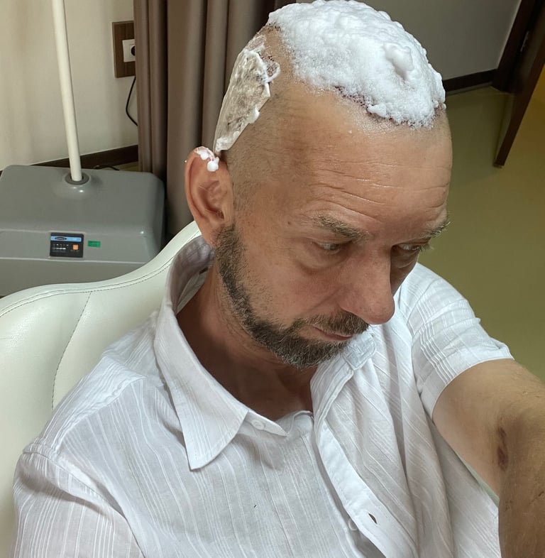 hair transplant dressings being removed