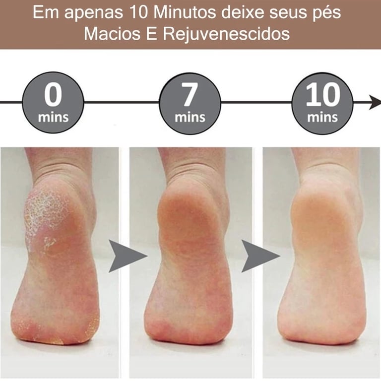 Lixador de Pé Elétrico - Esfoliador Tira Calos Pedicure Portátil