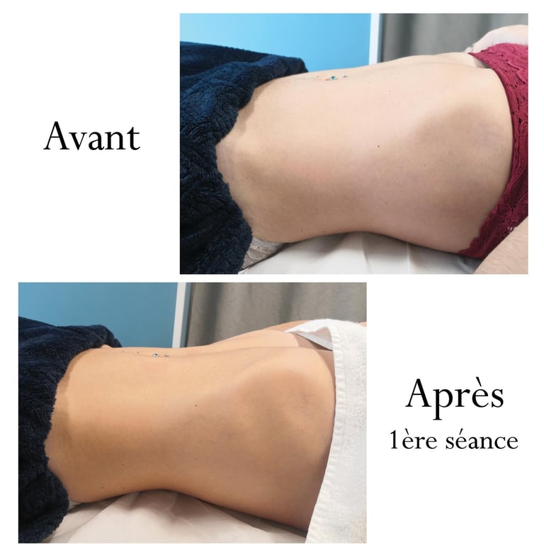 Renata França Ventre