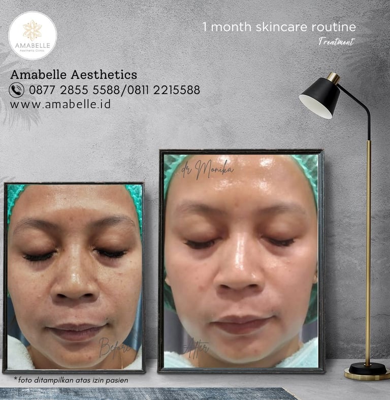 amabelle before after skincare routine