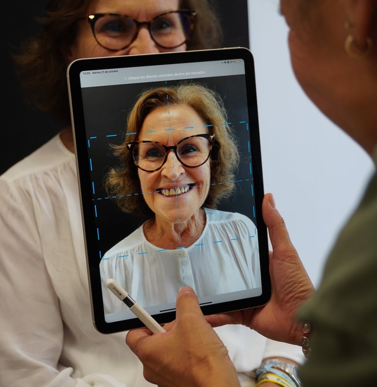 Diseño de sonrisa con Carillas en Sevilla