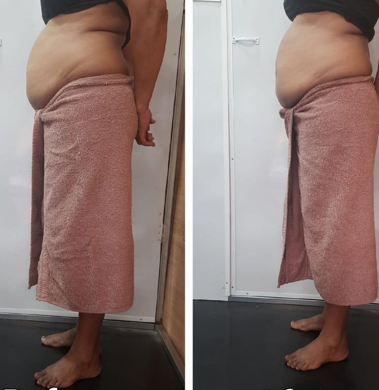 Slimmer waistline before and after fat cavitation body treatment