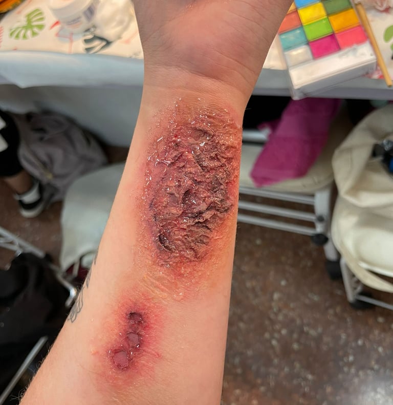 foto herida halloween