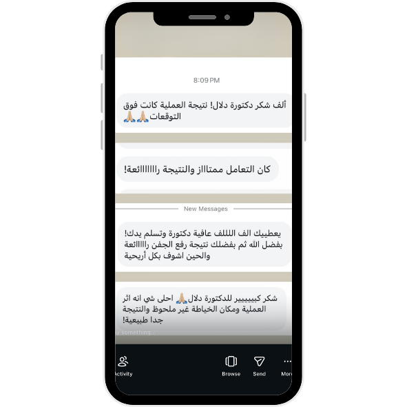 عمليات تجميل الجفون