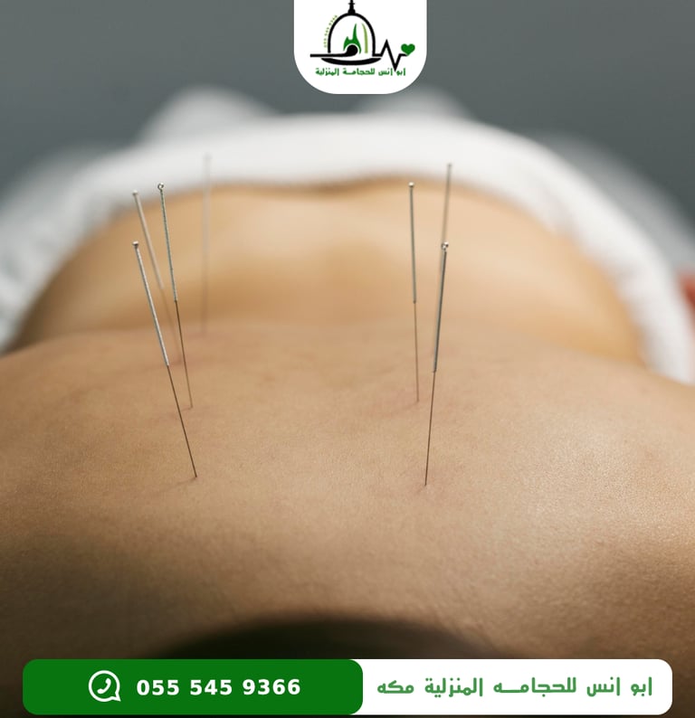 اخصائي ابر صينيه